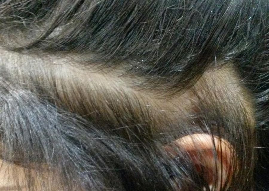 К чему снится Выпадение волос: Приснилось что волосы выпадают клочьями