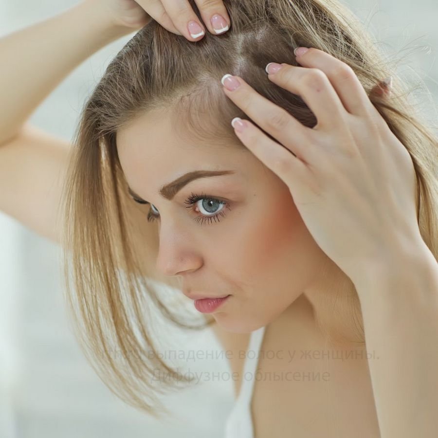 К чему снится выпадение волос - Сон выпадают волосы на голове у женщин
