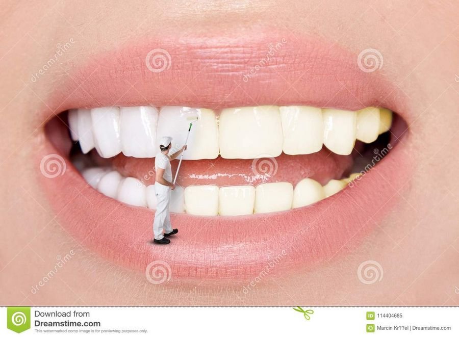 К чему снятся белые зубы. Зубы во сне для женщины